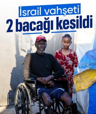 Gazze’de engelli kalan Filistinli, çadırda hayata tutunmaya çalışıyor