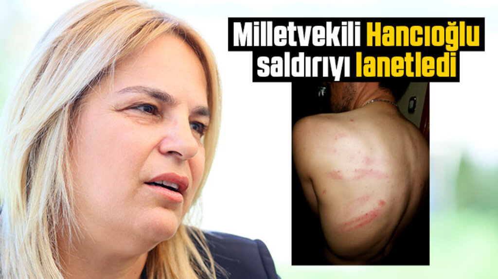 CHP Samsun Milletvekili Hancıoğlu İbrahim Akkuş'a yapılan saldırıyı lanetledi