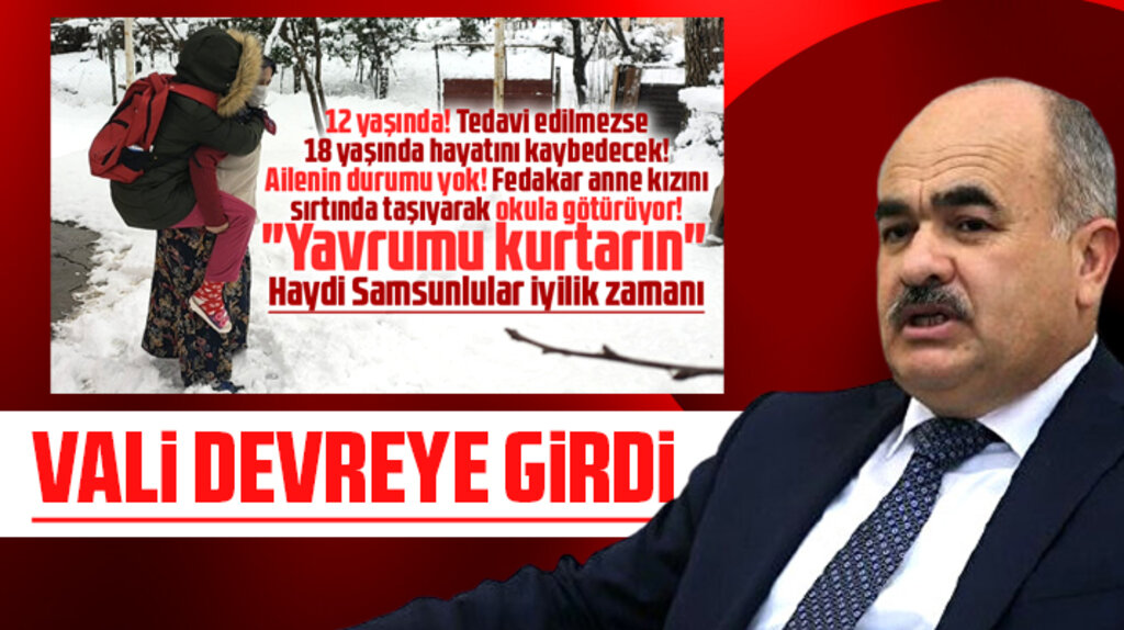 Samsun'da DMD hastası kızı için yardım isteyen annenin çığlığını Vali duydu!