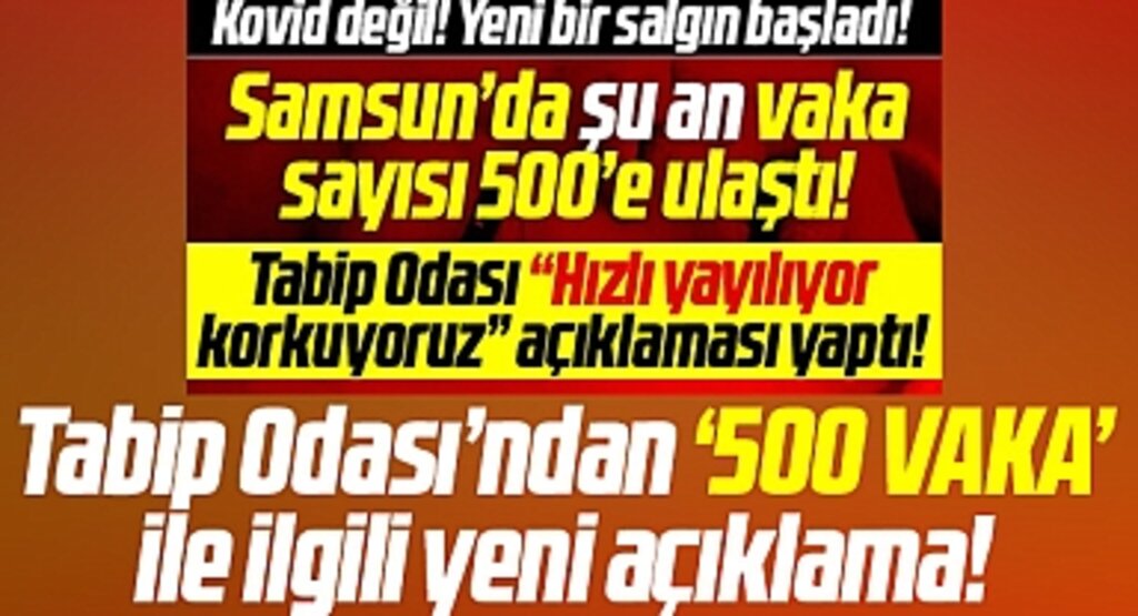 Samsun'da kızamık salgını mı var? 500 vaka ile ilgili yeni açıklama!