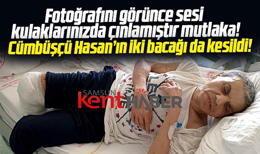 Samsun'da Cümbüşçü Hasan'ın son hali görenleri üzdü! İki bacağı da kesildi