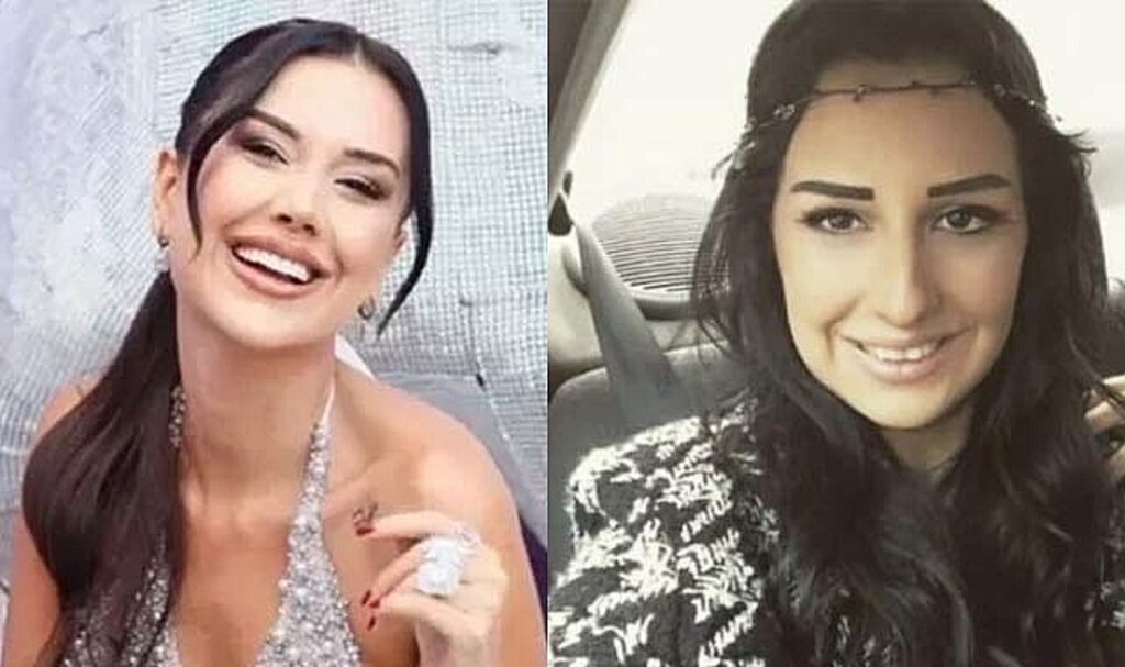 Dilan Polat'ın estetiksiz hali ağızları açık bıraktı! İşte 8 yıl önceki fotoğrafları
