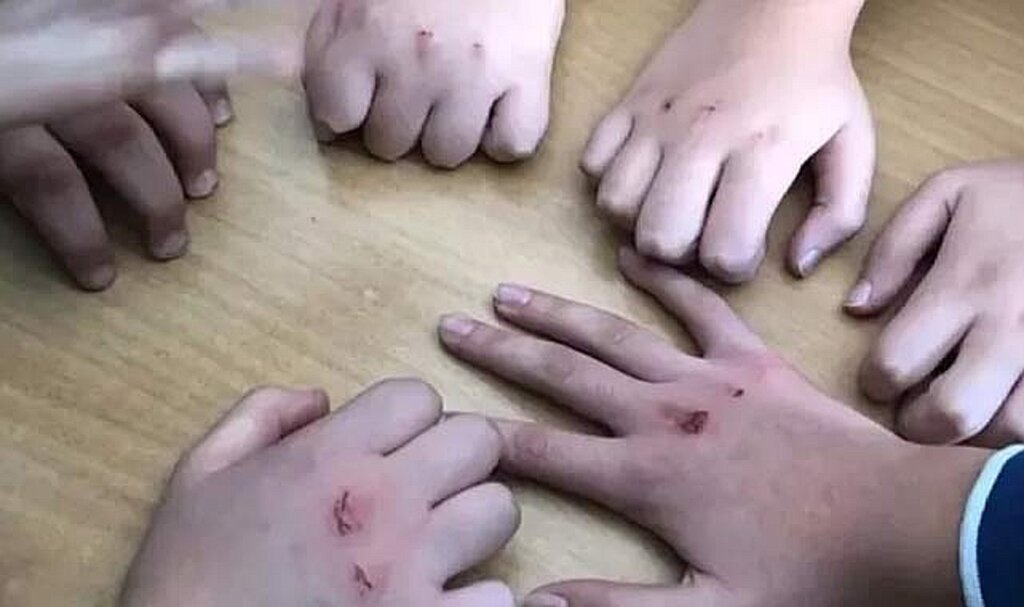 Kanlı para oyunu nedir! Çocuklarınız ellerinde yaralar varsa dikkat!