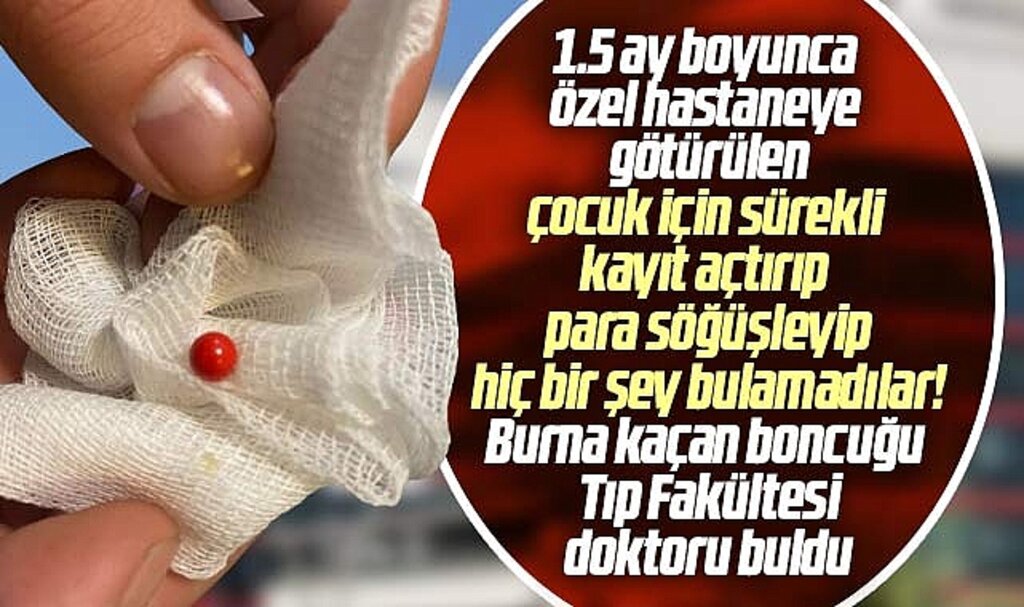 Samsun'da özel hastane doktoru ha bire kayıt açtırdı ama burna kaçan boncuğu bulamadı