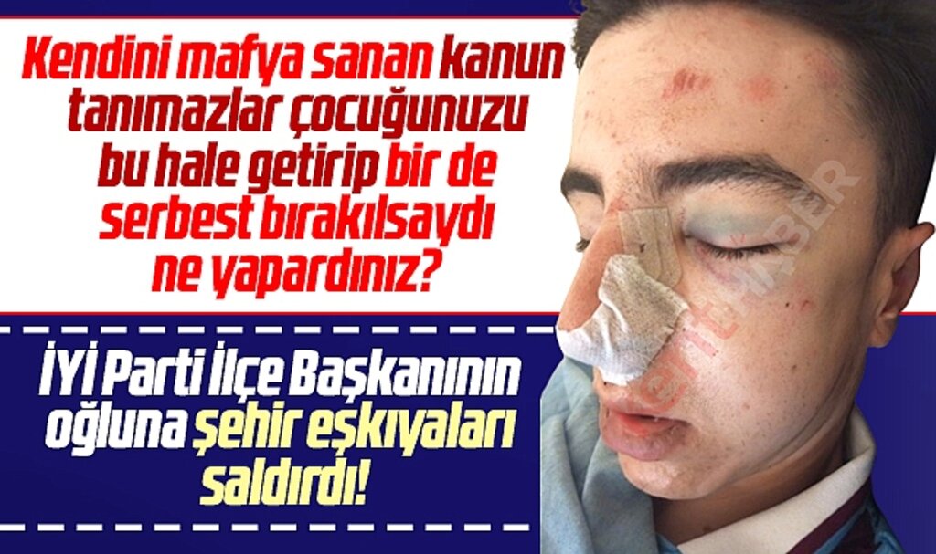 Samsun'da şehir eşkıyaları İYİ Parti Yakakent İlçe Başkanının oğluna saldırdı, serbest kaldı