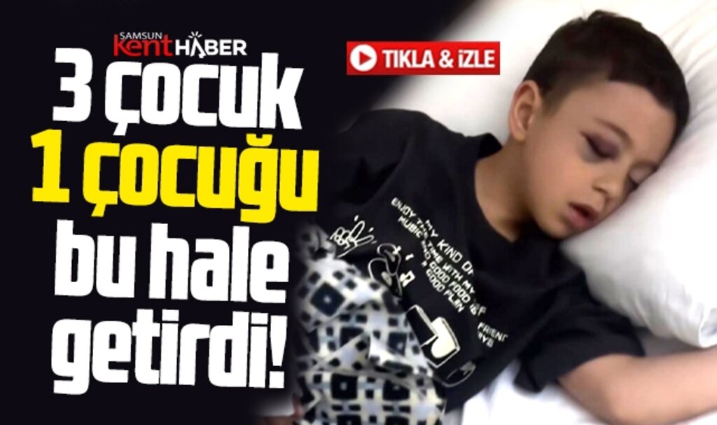 Samsun'da halı sahada 3 çocuk bir çocuğu hastanelik etti!