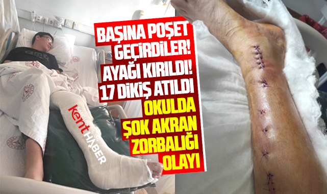 Samsun Final Okullarında şok akran zorbalığı! Öğrencinin ayağı kırıldı!