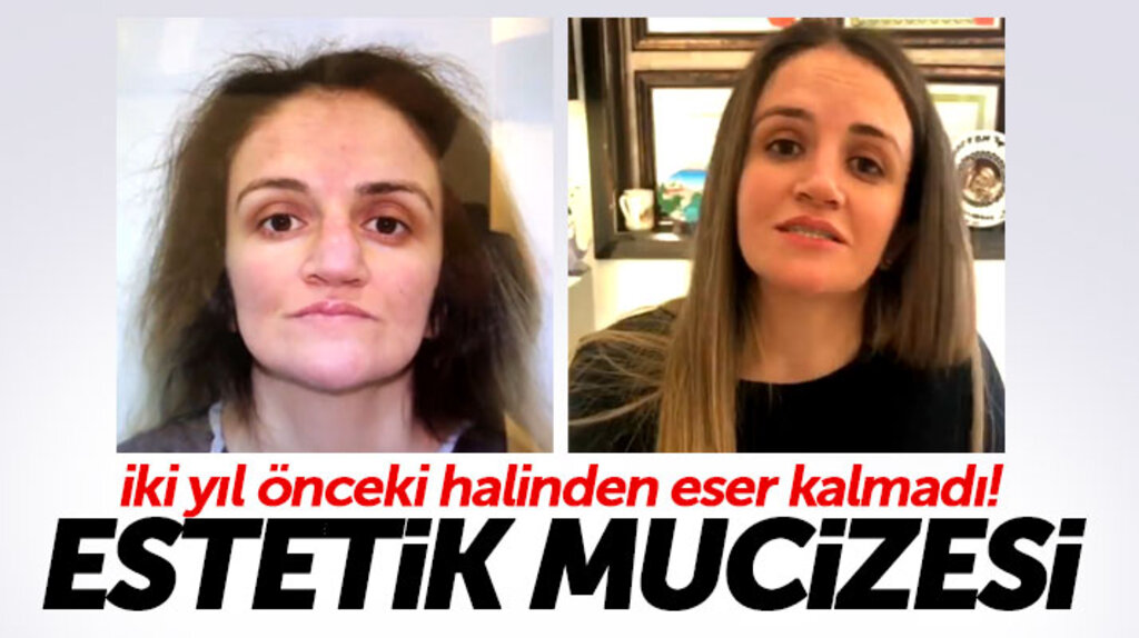 FBM Estetik Tıp Merkezi mucizeler yaratmaya devam ediyor
