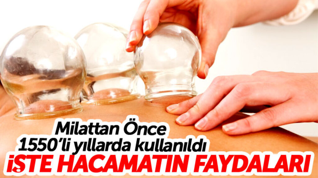 Kupa tedavisi ve hacamat nedir, sağlığımız için faydaları nelerdir