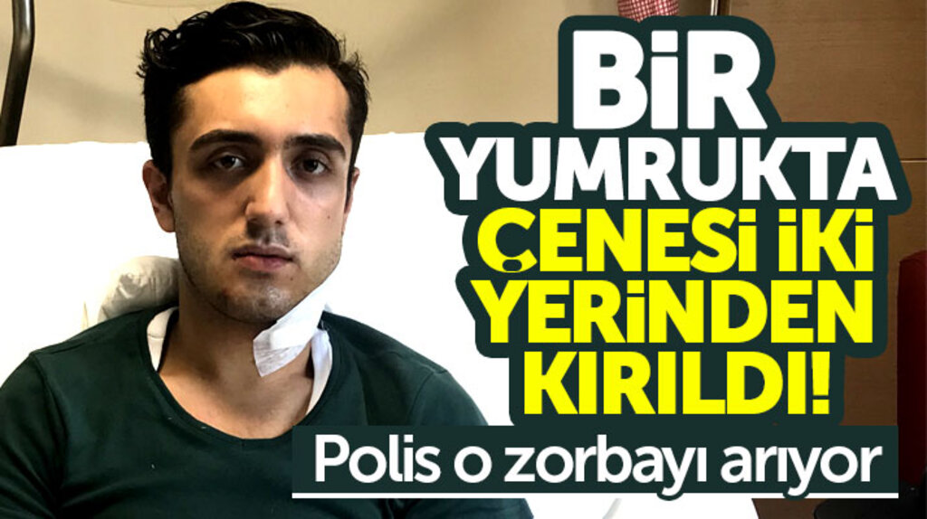 Samsun'da üniversite öğrencisinin trafikte yüzüne yumruk atıldı, çenesi iki yerinden kırıldı