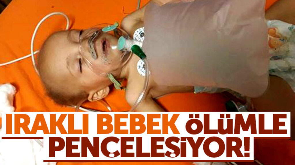 Samsun'da 14 aylık Iraklı mülteci bebek ölümle pençeleşiyor