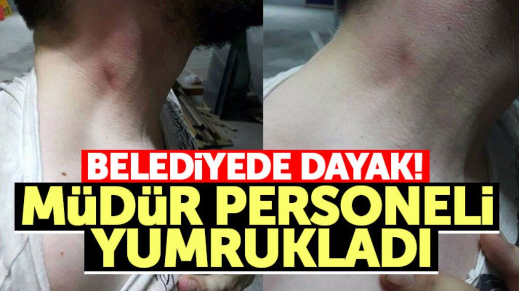 Samsun'un Canik İlçe Belediyesinde müdür, personele dayak attı iddiası!